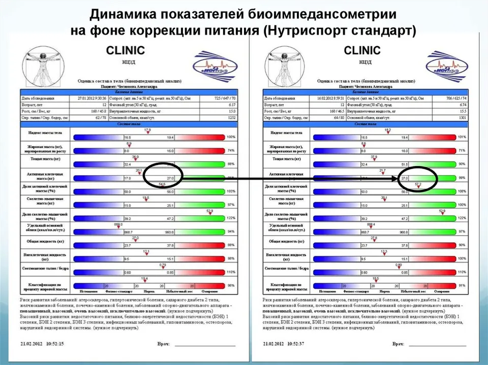 сделать биоимпедансометрию